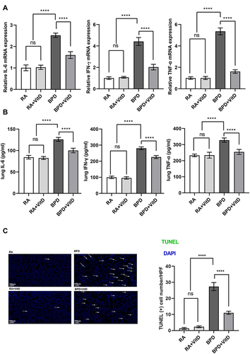 Figure 2 Vitamin D (VitD) treatment reduces the pro-inflammatory cytokines and represses the apoptosis in lungs of bronchopulmonary dysplasia (BPD) mice. (A) RT-qPCR detection of IL-6, IFN-γ, and TNF-α genes, showing their induction in the BPD mice and suppression by VitD treatment. (B) The protein levels of IL-6, IFN-γ, and TNF-α measured by ELISA showed their induction in the BPD mice and repression in the VitD treatment group. (C) The count of TUNEL-positive cells, detected by immunofluorescence, increased in the BPD mice and decreased with VitD treatment. TUNEL-positive cells were labeled with FITC fluorescence (green). The results shown were observed in at least three independent experiments. N = 10 mice per group; scale bar = 100 μm; magnification at × 10; ****p < 0.0001.