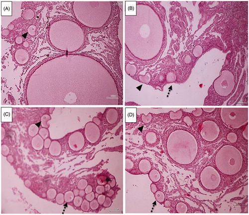 Figure 3 Laying hen ovarian tissues (n = 10 in each group). Intact primordial follicles (dash arrows) and atretic primordial follicles (arrow head). A: Control (basal diet), B: Vitamin E, C: n-3 + E, D: n-3. Basal diet +1.5% sunflower oil (control; C); basal diet +1.5% sunflower oil + 1.1 U alpha-tocopherol/hen/day (E); basal diet + 1.5% fish oil + 1.1 U alpha-tocopherol/hen/day (n-3 + E) and basal diet + 1.5% fish oil (n-3). Hematoxylin & Eosin staining (scale bar = 100 μm). Follicles with a maximum size of 80 μm were counted as primordial follicles. (Only the follicles with a visible nucleus were counted).