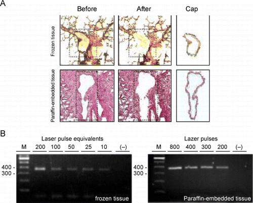 Figure 7. RT‐PCR of RNA extracted from cells obtained by laser capture microdissection (LCM). A. Representative micrographs of tissue sections stained with hematoxylin and eosin and captured cells processed by LCM. Top row represents a section of frozen lung tissue; bottom row: paraffin‐embedded lung tissue. Leftmost column represents sections before transfer of cells by LCM. The dashed line outlines the areas from which the cells will be transferred. Middle column represents the same sections after LCM. Note that the layer of airway tissue is absent. Rightmost column represents the cells that were captured onto the caps. The bar in the bottom right micrograph is representative of the magnification on all six micrographs and equals 200 µm. B. On the left is an agarose gel of the 375‐bp actin RT‐PCR products from 2‐fold serial dilutions of RNA that was extracted from airway cells captured with 200 laser pulses from frozen lung tissue and on the right, of RNA extracted from cells captured from paraffin‐embedded lung tissue using decreasing numbers of laser pulses. The lanes marked “−” represent RT‐PCR of the distilled water negative control. The leftmost lanes in each gel (M) are size markers with bp sizes indicated to their left. (Full color version available online.)