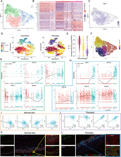 Figure 4 Cell clusters of keratinocytes and potential transition between cell clusters. (A) UMAP plot of all keratinocytes, colourcoded for three molecular clusters. See also Figures S3–S6. (B) Heatmap showing the expression patterns of 3 cell clusters in keratinocytes. (C) UMAP revealing the expression level of RHCG. (D) tSNE demonstrating the degree of differentiation of each keratinocyte cluster assessed by CytoTRACE. (E) Box plot showing the differentiation score of each keratinocyte cluster. (F) Monocle 3 pseudotime analysis for all keratinocytes. (G and H) Jitter plots showing the expression level of KRT1/10/16/17 and RHCG changing with pseudotime from Cluster 0 to Cluster 1 (G) and Cluster 2 (H). (I and J) The scatter plot demonstrating the correlation between RHCG and KRT1/10/16/17 in normal (I) and psoriatic skin (J) in merged GEO cohort. Spearman method was conducted. (K and L) Double IF staining images of RHCG and KRT1 and KRT16 in the mice normal (K) and psoriasis (L) samples biopsy. Scale bar, 100 mM. The representative views of co-staining were shown in the enlarged images at right (scale bar, 20 mM).