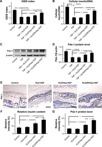 Figure 6 Effect of HGF-loaded SAP/Hep gel on β-cell function.Notes: (A) Evaluation of glucose stimulation index by GSIS test. (B) Determination of intracellular insulin level of β-cell in vitro. (C, D) Western blot and quantitative analysis of Pdx-1 protein level in β-cell in vitro. (E) IHC staining and (G) quantitative analysis of Pdx-1 protein level in vivo (scale bar =50 μm). (F) Relative insulin secretion by β-cells in vivo as determined by IHC staining. Data are mean ± SD. *P<0.05. 200× magnification.Abbreviations: K, lysine; L, leucine; D, aspartate; R, arginine; HGF, hepatocyte growth factor; SAP, self-assembling peptide; Hep, heparin; GSIS, glucose-stimulated insulin secretion test; IHC, immunohistochemistry; TNF, tumor necrosis factor.