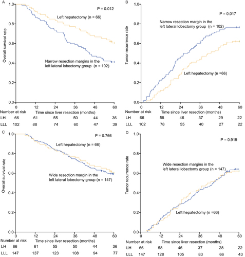 Figure 3 Overall survival and tumor recurrence of patients with HCC on the left lateral lobe who had wide resection margins and narrow resection margins in the LLL group and in the LH group. (A) Postoperative overall survival curve of patients with wide resection margin in the LLL and LH groups; (B) Postoperative tumor recurrence curve of patients with wide resection margin in the LLL and LH groups; (C) Postoperative overall survival curve of patients with narrow resection margin in the LLL and LH groups; (D) Postoperative tumor recurrence curve of patients with narrow resection margin in the LLL and LH groups.