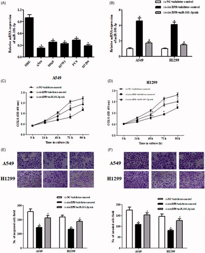 Figure 3. MiR-101-3p inhibitor prevented the effects of circZFR knockdown on NSCLC cells. (A) Expression levels of miR-101-3p in human NSCLC cell lines. *p < .05. (B) Transfection efficiency was confirmed after transfection with miR-101-3p inhibitor or control inhibitor in si-circZFR transfected A549 and H1299 cells. *p < .05 vs. si-NC + inhibitor-control; #p < .05 vs. si-circZFR + inhibitor-control. (C, D) Cell proliferation of A549 and H1299 cells was measured using CCK-8 assay. (E, F) Cell migration and invasion of A549 and H1299 cells was assessed using the Transwell assay. *p < .05 vs. si-NC + inhibitor-control; #p < .05 vs. si-circZFR + inhibitor-control.