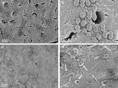 Figure 7 The morphology of Enterococcus faecalis on the surface of untreated dentin (a and b) and remineralized dentin (c and d) was examined using SEM. (a and b) The SEM images depict the approximate number and morphology of E. faecalis on the untreated dentin surface. (c and d) The morphology of E. faecalis on the surface of the remineralized dentin. The white arrows indicate abnormal bulges on the bacterial cell membrane and the ruptured bacterial envelopes.