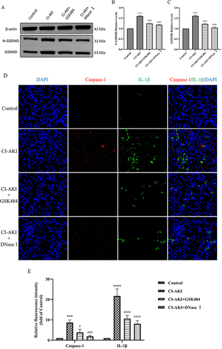 Figure 8 Reducing the level of NETs reduces pyroptosis. (A–C) Quantitative analysis of GSDMD and N-GSDMD protein in mouse kidney (n=3). (D and E) IF double staining and semi-quantitative analysis of Caspase-1 and IL-1β in mouse kidney tissue sections (n=3). * VS control group, ***P < 0.001, ****P < 0.0001, indicating statistically significant data between groups; # VS CI-AKI group, #P < 0.05, ###P < 0.001, ####P < 0.0001, indicating statistically significant data between groups. Magnification 630×.