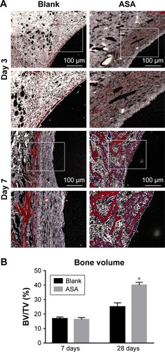 Figure 7 VG staining: representative undecalcified histological images of new bone formation around and within the implants detected by VG staining.Notes: (A) The bone tissue is stained red, and the fibrous tissue is stained yellow and white. (B) Histomorphometric measurement of bone volume fraction within the implants showed that the ASA group has the highest amount of new bone ingrowth, which is higher than that in the blank group (*P<0.05, n=3).Abbreviations: ASA, aspirin; BV/TV, the new bone volume fraction; VG staining, Van Gieson staining.