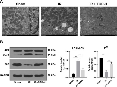 Figure 2 TGP attenuated autophagy in rats with AKI induced by I/R. (A) Autophagosome and autolysosome of rats in the sham group, IR group and IR + TGP-H group were detected using TEM assay; (B) the levels of p62 and LC3II/LC3I were detected using Western blot. N = 6. Data were expressed as mean ± standard deviation. Data in panel B were analyzed using one-way ANOVA, followed by Tukey’s multiple comparison test, **p < 0.01.