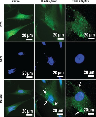 Figure 3 Association of NPs with cultured HDFn cells.Notes: Fluorescence laser scanning microscopy of cellular internalization of FITC-loaded SiO2/ZnO NPs (green). NP colocalization is indicated by arrows. The cell nucleus was stained with DAPI (blue). Scale bar 20 μm.Abbreviations: NPs, nanoparticles; HDFn, human dermal fibroblast neonatal; FITC, fluorescein isothiocyanate; DAPI, 4′,6-diamidino-2-phenylindole dihydrochloride; thin SiO2/ZnO, ZnO coated with a thin layer of SiO2; thick SiO2/ZnO, ZnO densely coated with SiO.