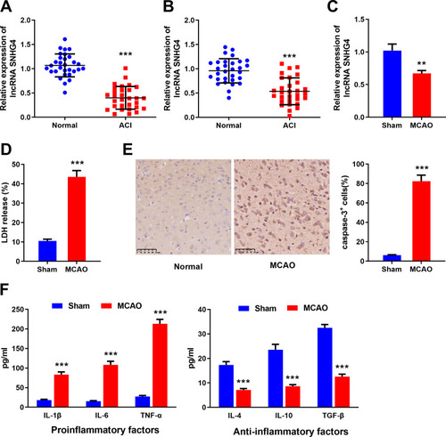 Figure 1 Expression of SNHG4 in cerebral infarction patients and rat MCAO model. (A-C) qRT-PCR was used to detect the expression of SNHG4 in blood and cerebrospinal fluid samples of patients and the brain tissues of MCAO animal model; (D) LDH detection assay was used to detect the expression of LDH in infarcted tissue of MCAO rats. (E) The activity of caspase-3 in the brain tissue of MCAO rats was detected by immunohistochemical staining; (F) ELISA was used to detect the levels of pro-inflammatory factors (IL-1 β, IL-6, TNF-α) and anti-inflammatory factors (IL-4, IL-10, TGF- β) in the brain tissue of MCAO rats. **P< 0.01, and ***P< 0.001 versus the healthy controls or sham group.