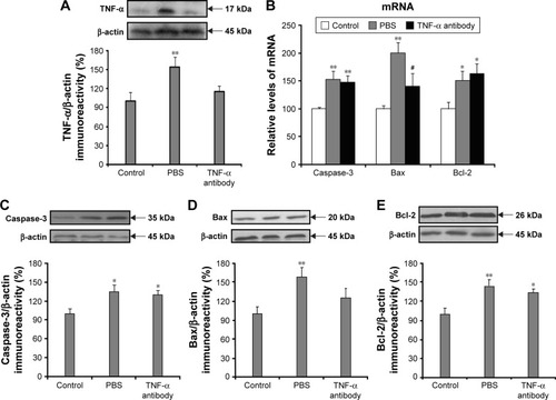 Figure 3 The effects of TNF-α antibody on the expression of caspase-3, bax and bcl-2 in the hypothalamus after SAH.