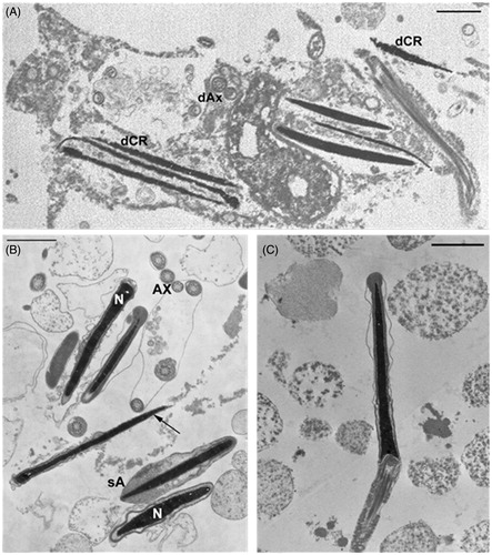 Figure 3. Micrographs of ejaculated spermatozoa (transmission electron microscopy). A) Spermatozoa from lipopolysaccharide (LPS)-treated rabbits (day 28 after LPS treatment) show altered plasma membranes, absent acrosomes, disorganized axoneme assembly (dAx) and disrupted chromatin (dCR); these alterations are typical characteristics of necrosis. B) Spermatozoa from LPS-chocolate-treated rabbits (day 28 after LPS treatment) show regular nuclei (N), acrosomes, and axonemes (Ax); spermatozoa with swollen (sA) or absent (arrow) acrosomes are also present. C) Normal spermatozoon from a LPS-Propolfenol® -treated rabbit. Bar 1 μm.