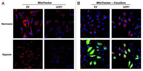 Figure 5. Expression of UCP1 decreases mitochondrial activity in fibroblasts. MitoTracker staining was used to visualize mitochondrial activity in homotypic cultures and in co-cultures of fibroblasts and GFP-positive MDA-MB-231 cells. MitoTracker accumulates in functional mitochondria with an active membrane potential, thus correlating with mitochondrial activity. (A) Fibroblast homotypic cultures were maintained under normoxia (upper panel) or hypoxia for 6h (Lower panel). DAPI was used to visualize nuclei (blue). Fibroblasts expressing UCP1 exhibit decreased MitoTracker staining (red), relative to empty vector (EV) control cells, consistent with impaired mitochondrial activity, in normoxia, and especially under hypoxia. (B) Fibroblasts (harboring EV or UCP1) and GFP-positive MDA-MB-231 cells were co-cultured for 48 h and maintained in hypoxia for 6 h prior to MitoTracker staining. Note that fibroblasts overexpressing UCP1 promote the mitochondrial activity in adjacent cancer cells, relative to empty vector (EV) control cells. In the top panels, only the red channel is shown, to appreciate the increased MitoTracker staining (red) of GFP-positive MDA-MB-231 cancer cells (green). Original magnification, 40X.