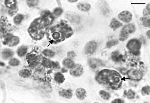Figure 4.  High magnification of an IPX-stained section of thymic cortex. Infected cells are markedly enlarged and circular inclusions are stained in several of the infected cells. Bar = 3 µm.