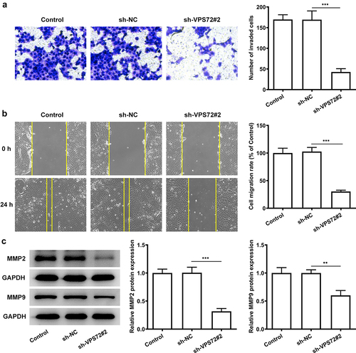 Figure 3. VPS72 knockdown suppressed the invasion and migration of HuH7 cells. (a) Cell invasion capacity of HuH7 cells was measured by transwell in the groups of control, sh-NC, and sh-VPS72#2. (b) Cell migration ability of HuH7 cells was detected by wound healing in the groups of control, sh-NC, and sh-VPS72#2. (c) Protein expression levels of MMP2 and MMP9 in HuH7 cells were examined by western blot in the groups of control, sh-NC, and sh-VPS72#2. Results were generated from three independent experiments and data were expressed as mean ± standard deviation (SD). **P < 0.01, ***P < 0.001.