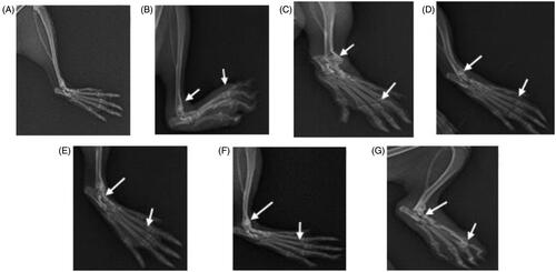 Figure 5. Radiographic images (X-ray) of right hind paw in CFA induced arthritic rats. (A) Normal control, (B) arthritic control, (C) Indo 5 mg/kg, (D) Dexa 0.5 mg/kg, (E) HP 25 mg/kg, (F) GA-AgNPs-HP 1 mg/kg and (G) GA-AgNPs 1 mg/kg. The arrows indicate degenerative changes in ankle joint, swelling around the soft tissues and articular changes.