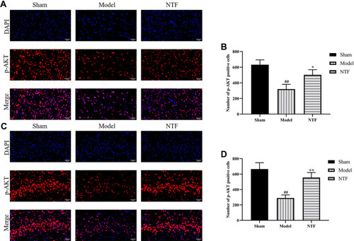 Figure 12 Effects of NTF extracts 7 days prior to CIRI on expression of p-AKT of the ischemic cortex and hippocampus in rats 24 h after reperfusion. (A) Representative images magnified 400 times in ischemic cortex sections examined with specific antibody against p-AKT (red); nuclei were stained with DAPI (blue). (B) The numbers of p-AKT positive cells in each group after 24 h of reperfusion in ischemic cortex. (C) Representative images magnified 400 times in ischemic hippocampus sections. (D) The numbers of p-AKT positive cells in each group after 24 h of reperfusion in ischemic hippocampus. All data were presented as mean ± SD. ##p<0.01 versus sham group; **p<0.01, *p<0.05 versus model group, respectively.