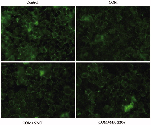 Figure 6. Inhibition of ROS or Akt effectively prevents the redistribution and dissociation of tight junction proteins induced by COM crystals in MDCK cells. MDCK cells were incubated with COM crystals for 48 h after pretreated with 10 mM NAC for 2 h or 5 μM MK-2206 for 24 h. Then, the cells were subjected to immunofluorescence analysis for ZO-1 using AlexaFluor-488-conjugated secondary antibody. MDCK cells grown in COM-free medium served as the control group. Original magnification was 400× for all panels.