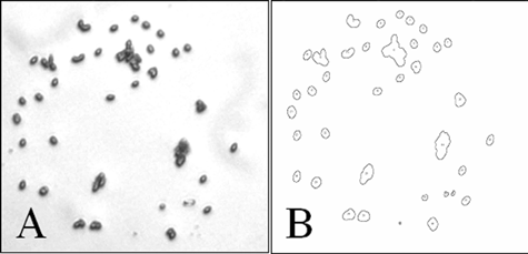 FIG. 2 Computer-assisted image analysis of aerosol particles. Imaging analysis of the pictures was performed using the Image Pro Express software (Media Cybernetics L.P Silver Spring, Maryland, USA) and Image J 1.31 (an image processing and analysis software in Java format developed at the National Institutes of Health, Bethesda, Maryland which is in the public domain). A) DIC micrograph of B. globigii spores within aerosol particles observed at 1000 × optical magnification and further enlarged digitally to identify individual and clustered spores. B) Particle boundaries obtained from picture A by computer-assisted analysis. Direct comparison of panels A and B allows correlation between particle size and the number of spores inside each particle.