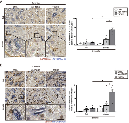 Figure 3. Fgf21-deficient PTECs are more reliant on autophagy for the degradation of increasing substrates. (A and B) Representative images of immunostaining for SQSTM1/p62 (A) and ubiquitin (B) in the kidney cortical regions of young CTRL, atg5F/F-TSKO, and TSDKO mice that were either fed or subjected to 48 hours of starvation (n = 3 to 5). Magnified images are presented in the insets. The number of SQSTM1/p62- or ubiquitin-positive dots was counted in at least 10 high-power fields (×400). Kidney sections were counterstained with hematoxylin and immunostained for the proximal tubule marker LRP2/MEGALIN in blue. Bars: 10 m. Data are provided as means ± SE. Statistically significant differences (*P < 0.05) are indicated.