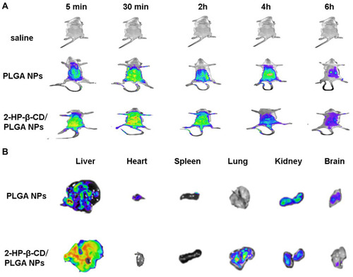 Figure 10 In vivo imaging and biodistribution analysis after tail vein injection of RDM-loaded NPs. (A) Real-time biodistribution imaging in mice. (B) In vitro visceral fluorescence imaging of mice organs after 6h post-injection.