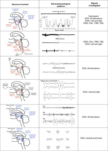 Figure 1 Examples of potential PD biomarkers expressed in polysomnographic signals and their neuroanatomical correlates.