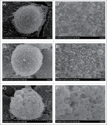 Figure 7. Morphological effect of toxins. Scanning electron microscopy photos of MDCK cells treated with PBS (A), rETXF199E (B), and wild-type epsilon toxin (C). D, E, and F are partial enlarged views of A, B, and C, respectively.