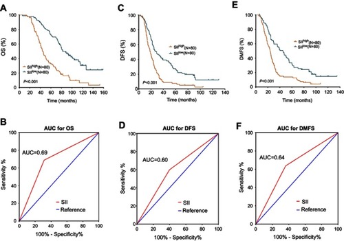 Figure 1 Kaplan-Meier and ROC curves for 160 TNBC patients. (A) OS as derived by the SII. (B) AUC of SII to differentiate between long and short OS. (C) DFS as derived by the SII. (D) AUC of SII to differentiate between long and short DFS. (E) DMFS as derived by the SII. (F) AUC of SII to differentiate between long and short DMFS.Abbreviations: ROC, receiver operating characteristic curve; TNBC, triple-negative breast cancer; OS, overall survival; SII, systemic immune-inflammation index; AUC, area under the curve; DFS, disease-free survival; DMFS, distant metastasis-free survival.