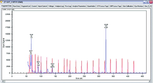 Figure 3. Gene expression levels of xylanase, β-xylosidase and glucose-6-phosphate dehydrogenase in Lactobacillus brevis.