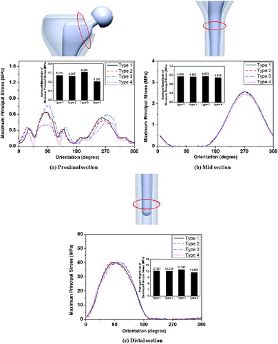 Figure 4. Maximum principal stress distribution around the cortical surface of proximal (a), mid (b) and distal (c) areas of the femur.