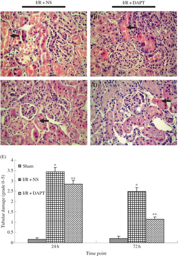 Figure 3. The effect of DAPT on the Histology: (A–D) Renal histological changes at 24 h, 72 h after renal IRI, (A) I/R + NS group at 24 h; (B) I/R + DAPT group at 24 h; (C) I/R + NS group at 72 h; (D) I/R + DAPT group at 24 h; and (E) semi-quantitative score of tubular damage. Each column represents the mean of acquired data (mean ± SEM), *p < 0.05 versus sham group at the same time point. **p < 0.05) versus I/R + NS group at the same time point.