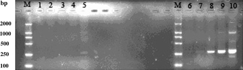 Figure 2.  Analysis of hybridization efficiency. PCR was performed on subtracted (lanes 1 to 5) or unsubtracted (lanes 6 to 10) secondary PCR product with the G3PDH 5′ and 3′ primers. Lane M, DNA maker II; lanes 1 and 6, 18 cycles; lanes 2 and 7, 21 cycles; lanes 3 and 8, 24 cycles; lanes 4 and 9, 27 cycles; lanes 5 and 10, 30 cycles.