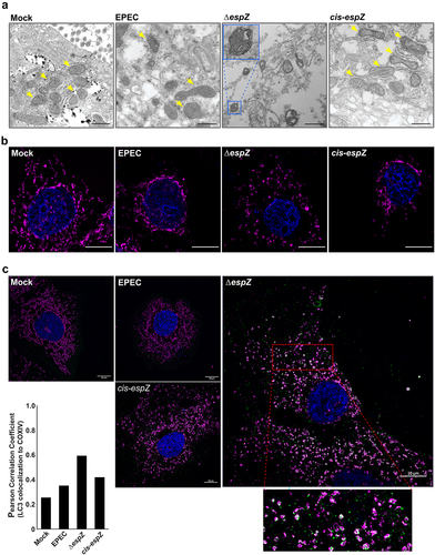 Figure 4. EPEC EspZ inhibits mitochondrial fission and mitophagy. C2BBe cells were mock-treated or infected with WT EPEC, ∆espZ, or cis-espZ. A, Transmission electron micrographs of mock-treated (left-most panel) or infected C2BBe showing mitochondria (yellow arrows). Inset shows mitochondria enclosed within double membranes, suggestive of mitophagy. Scale bar: 500 nm. Images are representative of >6 fields captured per sample from five independent experiments. B, Immunofluorescence staining of mock-treated or infected C2BBe for COXIV (magenta); DNA was stained with DAPI (blue). C, Mock-treated or infected C2BBe were stained for COXIV (magenta), LC3 (green) and DAPI (blue). Scale bar: 10 μm. Inset shows zoomed image of LC3 colocalization with mitochondria. Images shown are representative of >6 images captured from three independent experiments. Chart depicts Pearson correlation coefficients of LC3 colocalized to COXIV.