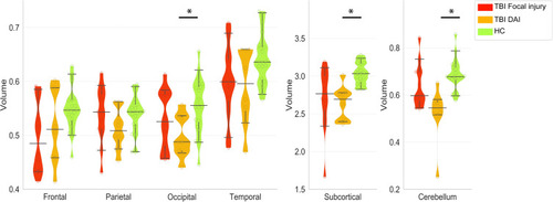 Figure 4 Violin and whisker plot shows 5% and 95% confidence intervals (whiskers) and the median of the mean volume of each region of interest in patients with focal injury (red) or DAI (orange) and healthy controls (green). Mean volumes of the DAI patients in the occipital cortex, subcortical, and cerebellum were significantly lower than those of healthy controls. *p<0.05, Wilcoxon rank sum test, FWE.