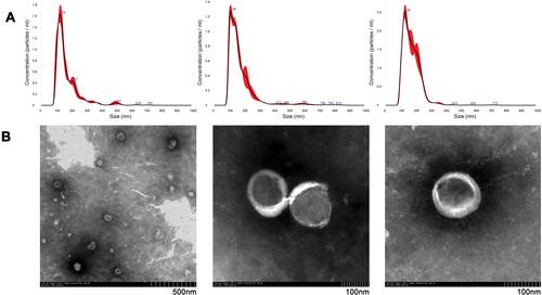 Figure 1 Characteristics of three representative urinary extracellular vesicles observed by Nanoparticle Tracking Analysis (NTA) and Transmission Electron Microscope (TEM). (A) The distribution and concentration of urinary extracellular vesicles were evaluated using NTA. (B) Electron morphology of urinary extracellular vesicles under TEM. The original magnification was ×10.0k, ×30.0k, ×40.0k in sequence from left to right.