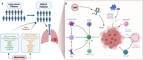 Figure 3. Conceptual framework for albumin-related inflammatory markers in the prognosis and immune microenvironment of non-small cell lung cancer. (A) Increased or decreased albumin-related inflammatory markers predict poor prognosis in patients with non-small cell lung cancer. (B) Albumin, C-reactive protein, and peripheral blood cells play a role in the immune microenvironment of NSCLC. Figure created with BioRender.com. CAR: C-reactive protein albumin ratio; GPS: Glasgow prognostic score; mGPS: modified Glasgow prognostic score; Hs-mGPS: high-sensitivity modified Glasgow prognostic score; a-GPS: adjusted Glasgow prognostic score; PNI: Prognostic nutritional index; ALI: Advanced lung cancer inflammation Index; COA-NLR: Alb concentration combined with NLR; NLDA: NLR × D-dimer count/albumin; ANPG: albumin and neutrophil combined prognostic grade; HALP: haemoglobin: albumin: lymphocyte and platelet score; DC: dendritic cell; MDSC: myeloid-derived suppressor cell; CAF: cancer-associated fibroblast; NK: natural killer.