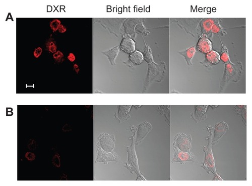 Figure 5 Confocal laser scanning microscopy image of KB cells incubated with F–PLL-coated liposomal DXR for 3 hours at 37°C (A) without or (B) with 5 mM FA in culture medium.Note: The scale bar represents 10 μm.Abbreviations: DXR, doxorubicin; FA, folic acid; F-PLL, folate-poly(L-lysine).