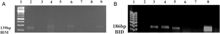 Figure 6. BIM and BID gene promoter regions are unmethylated in K562 and K562/IMA-3 cell lines. (A) (1) M:50 bp, (2) K562 cells BIM unmethylated band, (3) K562 cells BIM methylated sample, (4) K562/IMA-3cells BIM unmethylated band, (5) K562/IMA-3cells BIM methylated sample, (6) peripheral blood sample BIM unmethylated band, (7) peripheral blood sample BIM methylated sample, (8) (+) control BIM unmethylated band, (9) (+) control BIM methylated band. (B) (1) M:50 bp, (2) unmethylated negative control, (3) K562 cells BID unmethylated band, (4) K562 /IMA-3 cells BID unmethylated band, (5) unmethylated positive control, (6), K562 cells BID methylated sample, (7) K562 /IMA-3 cells BID methylated sample, (8) methylated positive control.