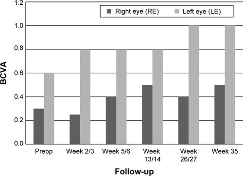 Figure 9 Data from patient number 3 showing visual acuity (BCVA) at preop and postop visits.