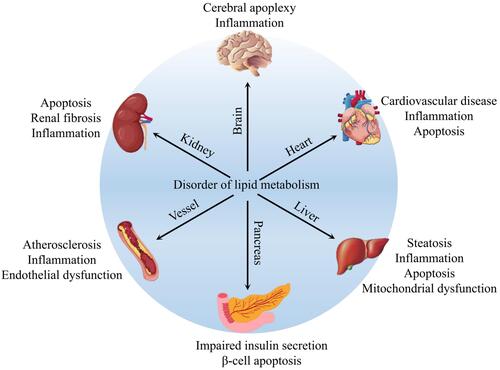 Figure 1 The relationship between lipid metabolic disorders in different organs and tissues.