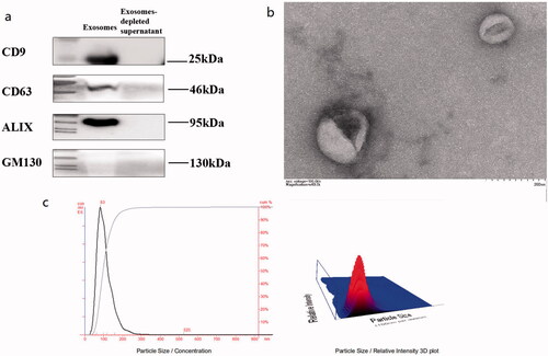 Figure 1. Characteristics of extracellular vesicle (EV) in subjects. 15 mL of morning urine from subjects was collected. Extracellular vesicles were extracted from urine by high-speed centrifugation (12000 × g, 30 min), ultrafiltration enrichment (100KD, 15 mL) and ExoQuick™ Exosome Precipitation Kit (EXOTC50A-1, SBI System) Resuspend in 1x PBS and store in −80 °C freezers until use. (a) WB results for exosome marker evaluation; PBS served as a negative control. (b) Electron Microscopy of Exosomes. (c) Particle size analysis of exosomes by nanoparticle tracking analyzer.