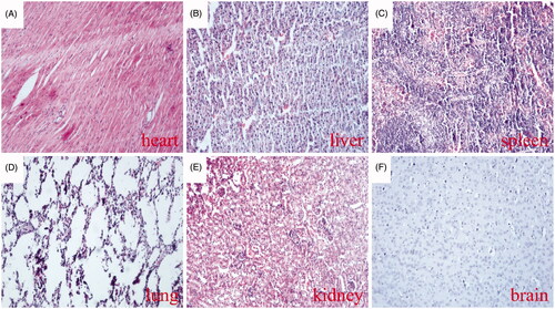 Figure 9. Thrombotic risk assessment in the normal organs of the treated mice. Histological analysis of various normal organs of tumour-bearing mice treated with the MTPCP. Sections of heart (A), liver (B), spleen (C), lung (D), kidney (E) and brain (F) were stained with haematoxylin and eosin (H&E).