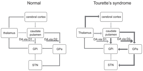 Figure 1 Schematic representation of basal ganglia circuitry (modified from Visser-Vandewalle et al 1997), with excitatory (glutamatergic) projections Display full size and inhibitory (GAB-Aergic) projections →. Normally, dopamine, acting via D1 dopamine receptors, has an excitatory influence on striatal projections to the GPi and, acting via D2 dopamine receptors, an inhibitory influence on striatal projections to the GPe, maintaining a balance between the activities of the direct and indirect basal ganglia pathways. According to the dopaminergic hypothesis of TS pathophysiology, dopaminergic hyperactivity causes increased activity in the direct pathway (indicated by the heavier weighted lines) and decreased activity in the indirect pathway, which serves to enhance thalamocortical activity. In TS, the thalamus, caudate-putamen, and GPe become pathologically hyperactive, and the GPi and STN become pathologically hypoactive.