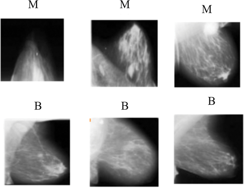 Figure 8. Some examples of breast cancer images with high uncertainty (≥0.1) in predictions from mammograms which can be selected as appropriate subsets for further inspection. Predictive entropy is considered as the model uncertainty. (M and B are predicted labels as malignant and benign, respectively).