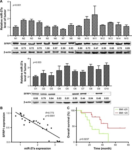 Figure 6 Expression of miR-27a and SFRP1 in HCC tissues of patients.