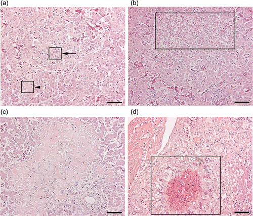 Figure 2.  Microscopic lesions observed in livers of the chickens infected by the WT and SCV strains of S. zooepidemicus. 2a: Lesion type A, micro-multifocal degeneration- very tiny areas of hepatocytes with a ghost-cell or necrotic appearance, (i.e. disintegrated eosinophilic hepatocytes with fading nuclear staining or disappearance of nuclei in some cells) (arrow-head), as opposed to normal appearing hepatocytes (arrow). 2b: Lesion type B, necrotic and/or separation of hepatocytes with infiltration of heterophils, mononuclear and lymphoid cells (box). 2c: Lesion type C, amorphous eosinophilic material replacing hepatocytes with infiltration of mononuclear cells, lymphoid cells and few heterophils. 2d. Lesion type D, pyo-granulomas consist of central necrosis with infiltration of heterophils, peripheral macrophages and giant cells (box). Haematoxylin and eosin stain. Scale bar: 50 micrometers.