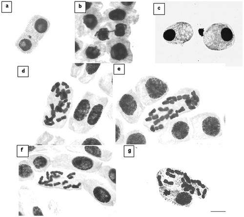 Figure 1. Irregularities found in the cells of Allium cepa under the treatments with Psidium cattleianum juices. (a) Cell with micronucleus treated with yellow strawberry guava juice 125 g l−1 (Distrito de Palma) – T3. (b) Cell with bridges in telophase treated with red strawberry guava juice 125 g l−1 (Universidade Federal de Santa Maria) – T4. (c) Cells in apoptosis treated with the positive control – T5. Cells with irregular metaphases: (d, e) Treatment with yellow strawberry guava juice 125 g l−1 (Distrito de Arroio Grande) – T2; (f) treatment T3; (g) treatment T4. Scale: 10 μm.