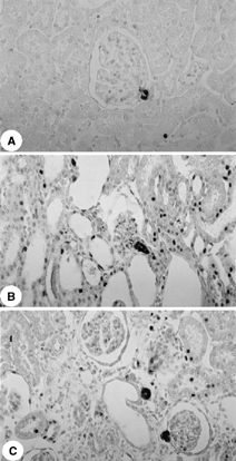 Figure 2. Immunolocalization of AII in the renal cortex from a control rat (A) and from rats killed 5 (B) and 30 days (C) after glycerol injection. Note that the number of AII-positive cells is higher in B and C than in A. × 280.