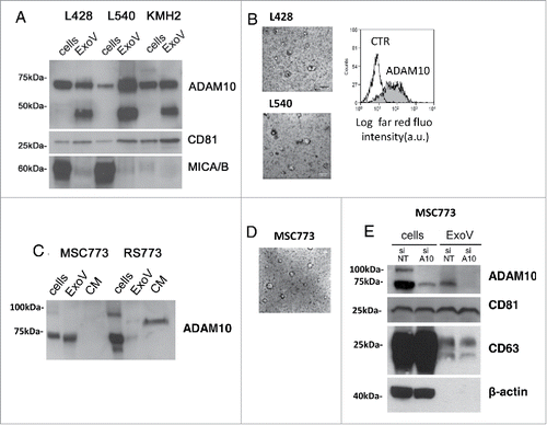 Figure 1. ADAM10 mature form in ExoV is released by MSC and HL cells. Panel A: Post nuclear supernatants (cells) or exosome-like vesicles (ExoV), prepared from the conditioned medium (CM) of L428, L540 or KMH2 HL cells (107) by differential centrifugation, were lysed, subjected to western blot, probed with the anti-ADAM10 antiserum or the anti-CD81 or the anti-MICA/B mAb, followed by HRP-labeled antibodies and developed with ECL. MW markers (kDa) are indicated on the left. Panel B: Transmission electron microscopy (TEM) analysis of L428 or L540 cell ExoV (left panels). Flow cytometry analysis (right panel) of L428 ExoV conjugated overnight with latex beads (4 μm) and stained with the anti-ADAM10 antibody followed by an APC-conjugated antiserum (grey histogram) or with the APC-antiserum alone (white histogram). Panel C: ExoV and CM from MSC773 or RS773 HL cells were subjected to western blot for ADAM10 as in panel A. Panel D: TEM images of stromal ExoV from MSC773. Panel E: MSC773 cells were silenced with specific (A10) or non-targeting (NT) siRNA pool. Cell lysates, or lysates from ExoV purified from NT or A10 MSC supernatants, were subjected to western blot as in panel A and probed with anti-ADAM10 mAb or mAbs against the exosomal markers CD81 and CD63, as in panel A, or the anti-β-actin mAb. MW markers (kDa) are indicated on the left.