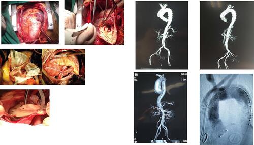 Figure 2 Operative photos.