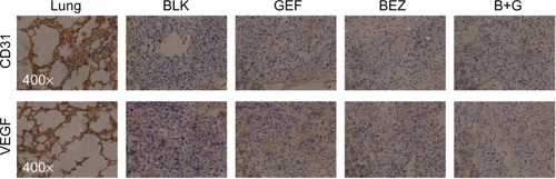 Figure 5 BEZ235 combination with gefitinib reduced VEGF and CD31 expression in vivo.